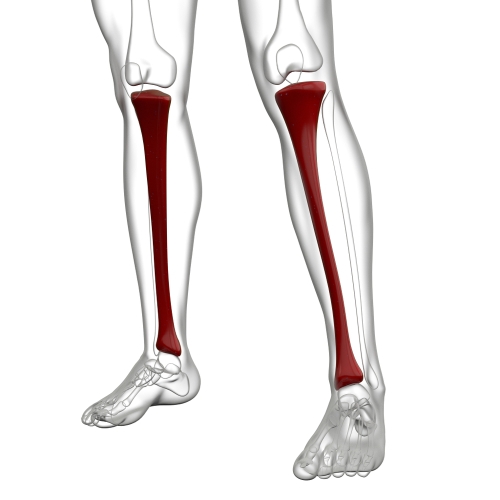 Medial Tibial Stress Syndrome, Shin Splints